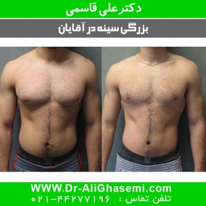 بزرگی سینه در آقایان