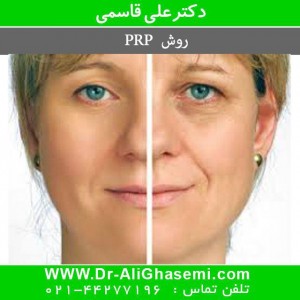 پی آر پی پوست