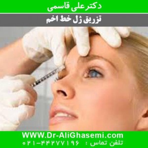 تزریق ژل در خط اخم
