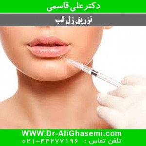 ژل لب