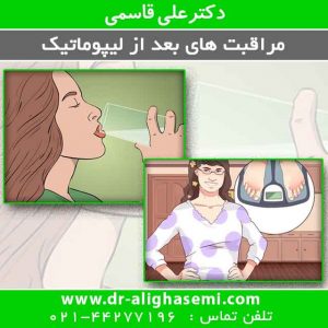 مراقبت های بعد از لیپوماتیک