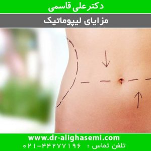 مزایای لیپوماتیک