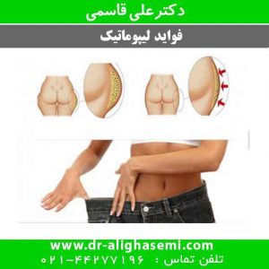 فواید لیپوماتیک