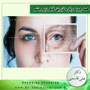 ‎همه چیز درباره تزریق فیلر زیر چشم